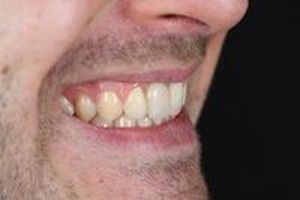 дентална клиника софия - 24982 промоции