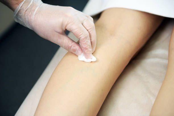 склеротерапия - 75742 промоции